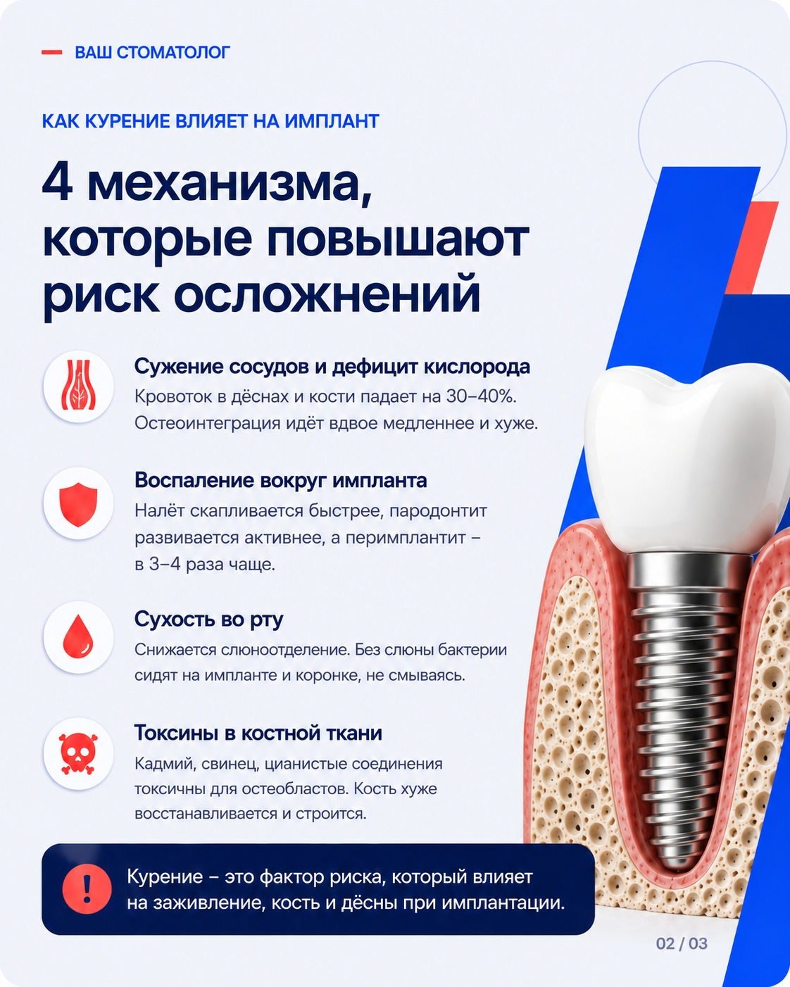 Четыре механизма влияния курения на имплант